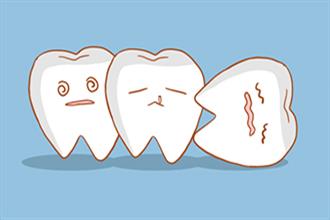 有一种尴尬叫吃饭塞牙！口腔专家：多半是这5种牙病在作祟